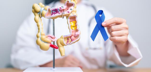 Origen de factores del cáncer colorrectal temprano en la infancia