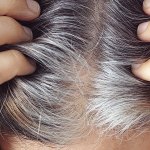 ¿Por qué aparecen canas en personas jóvenes?