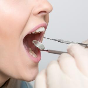 Importancia del Cuidado Bucodental en la Prevención de Enfermedades Cardiovasculares