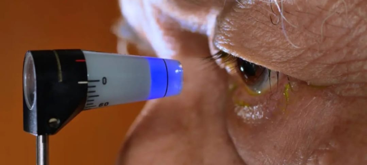 Oftalmología oncológica: Detectando tumores oculares