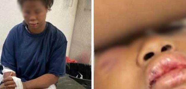 Rescate de joven raptada y golpeada por expareja: detenidos agresor y cómplice