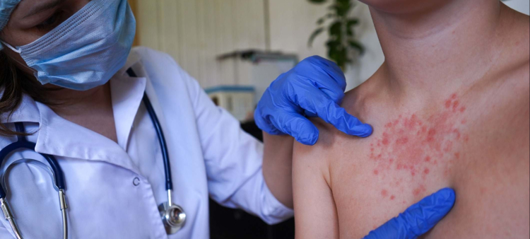 Alerta de la Sociedad de Infectología sobre el riesgo de sarampión en la República Dominicana