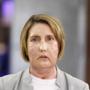 Primer trasplante facial mundial con donante de eutanasia en Barcelona