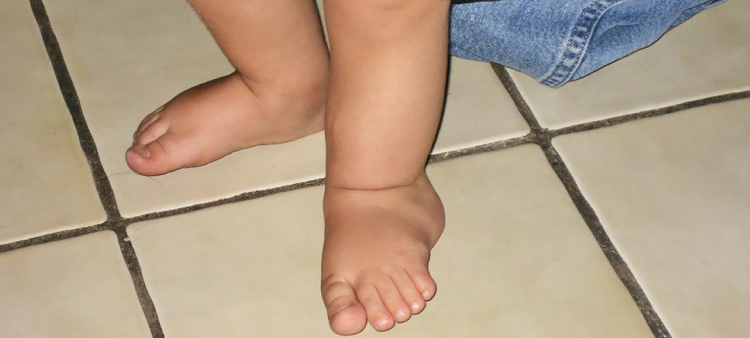 Cirugía pionera realizada en un niño
