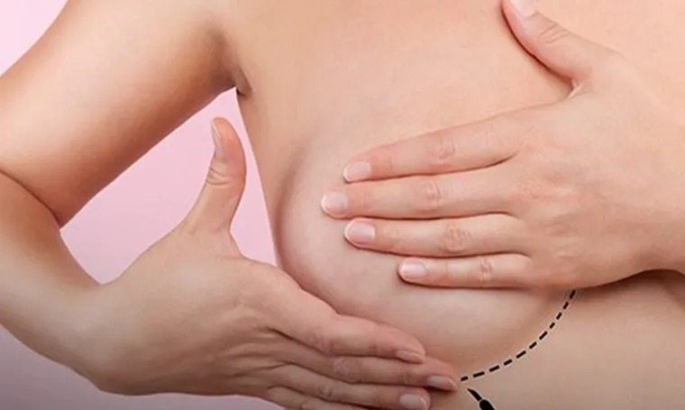 Descubren células híbridas responsables del cáncer de mama