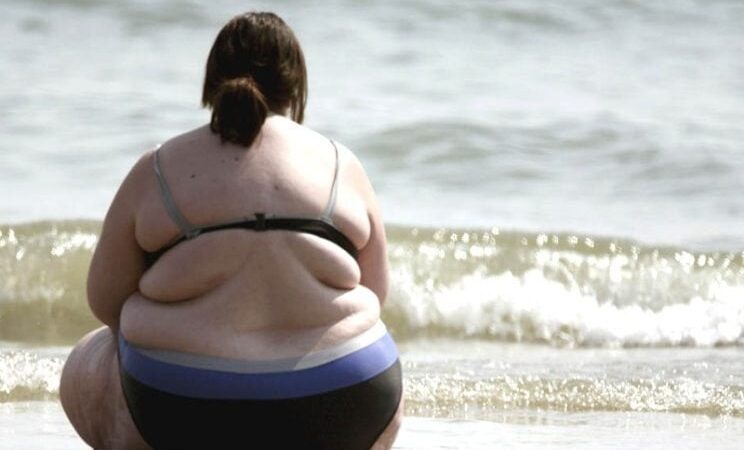 La obesidad deja una huella duradera en el sistema inmunológico, según estudio