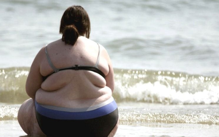 La obesidad deja una huella duradera en el sistema inmunológico, según estudio
