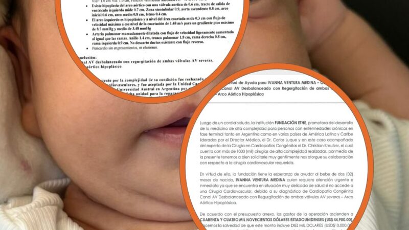 La vida de Ivanna depende de un urgente apoyo solidario