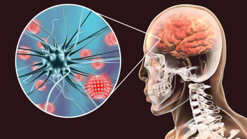 Salud Pública registra aumento de casos sospechosos de meningitis en el país