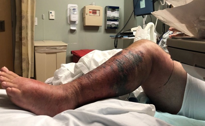 Alerta sanitaria en Long Island ante la presencia de bacteria mortal