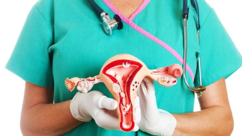 Desafíos del cáncer de cuello uterino y el VPH en el país