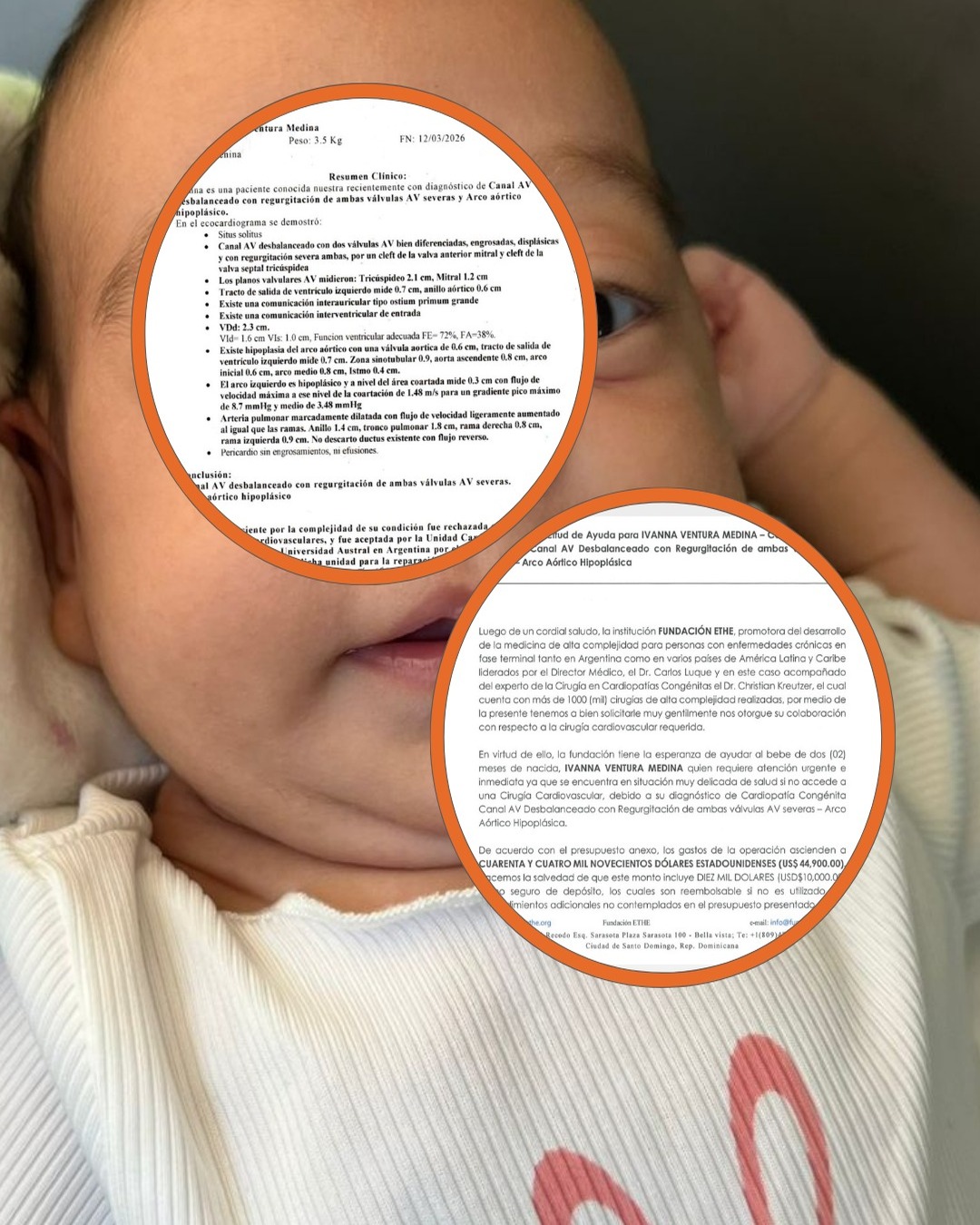 Urgente: Ivanna necesita un corazón para vivir