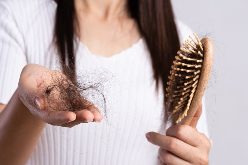 La caída del cabello podría indicar una enfermedad de transmisión sexual