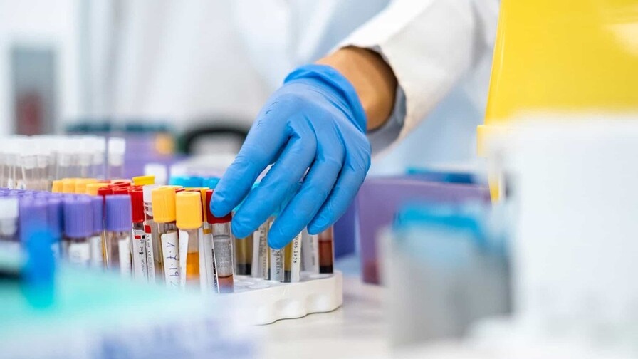 Innovador test detecta cáncer de páncreas mediante análisis de sangre