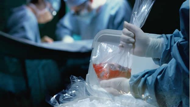 Desafíos y Esperanzas en la Espera de Trasplantes Pediátricos en República Dominicana