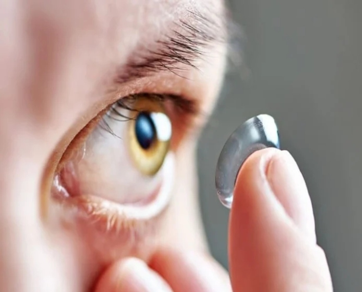 Lentes de Contacto: Más Allá de la Estética, una Solución Médica