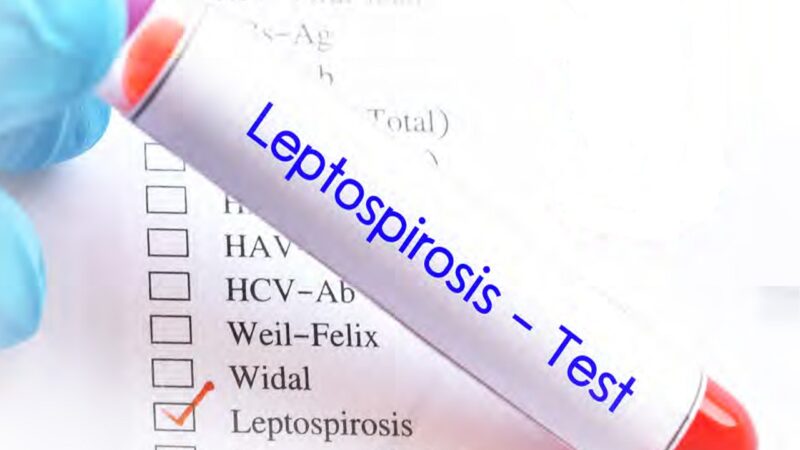 Aumento Preocupante de Muertes por Leptospirosis en República Dominicana