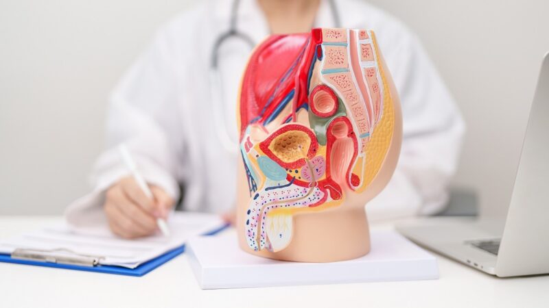 Cáncer de Próstata: La Amenaza Silenciosa que Afecta a los Hombres
