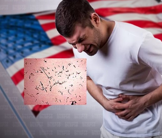 Autoridades de Nueva York Alertan sobre Aumento de Ciclosporiasis en Productos Frescos