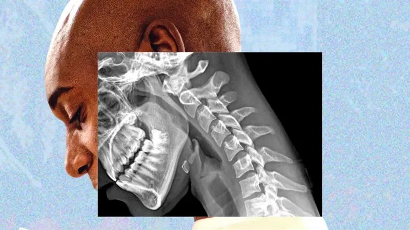Impacto de la Tecnología en Nuestro Cuerpo: Más Allá de la Pantalla