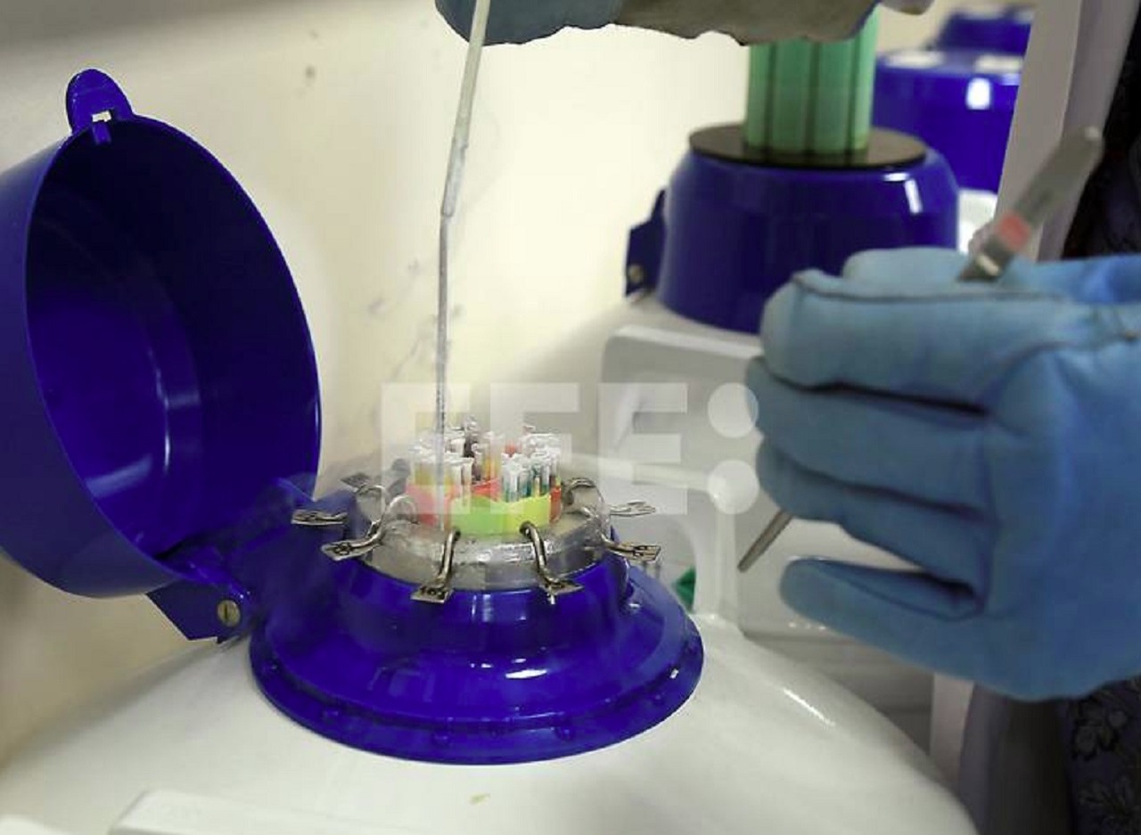 Impacto de la Contaminación en la Calidad del Semen: Un Estudio Revelador