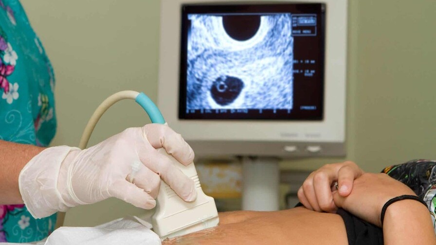 El Debate Sobre el Aborto: Un Análisis Profundo de las Tres Causales