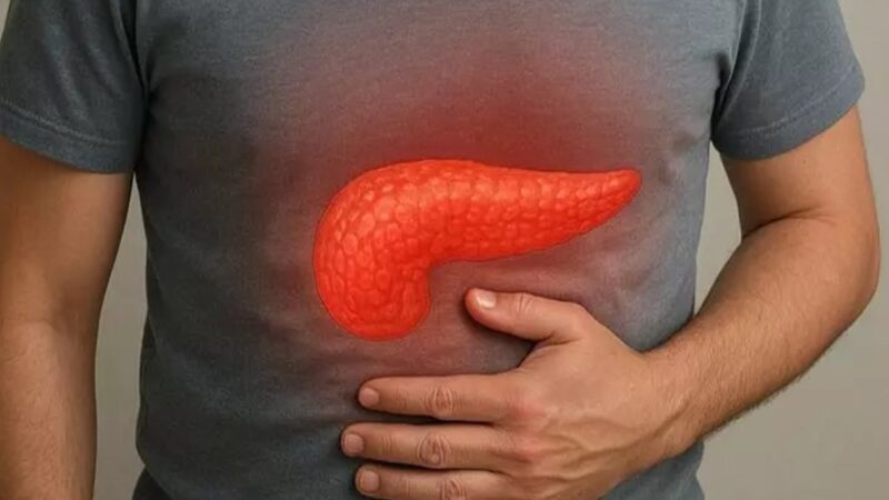 Aumento de Pancreatitis Aguda Vinculado a Obesidad y Cálculos Biliares