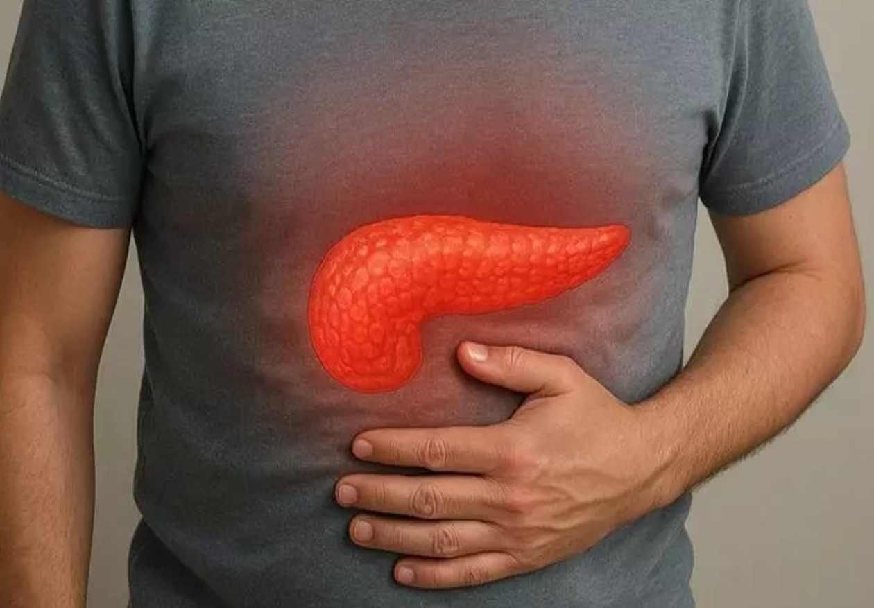 Aumento de Pancreatitis Aguda Vinculado a Obesidad y Cálculos Biliares