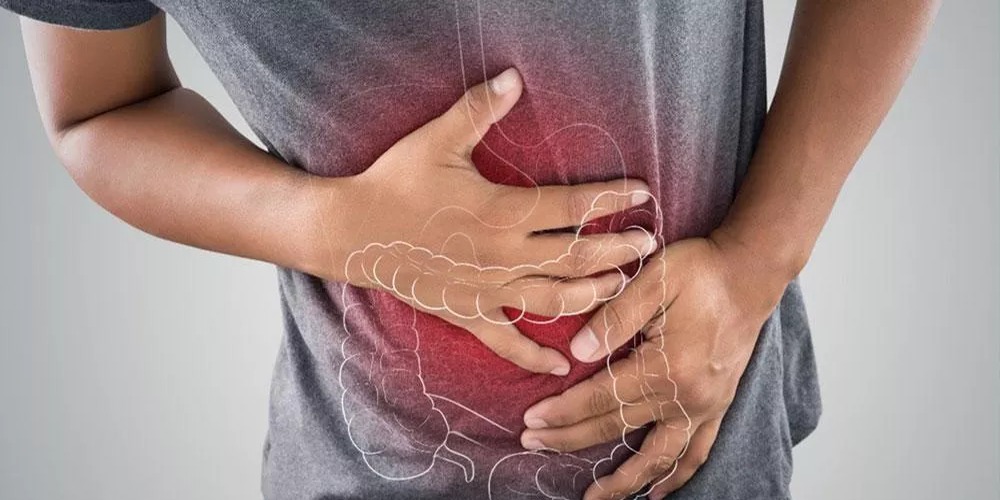 Aumento del Cáncer Colorrectal en Jóvenes: Un Desafío Emergente