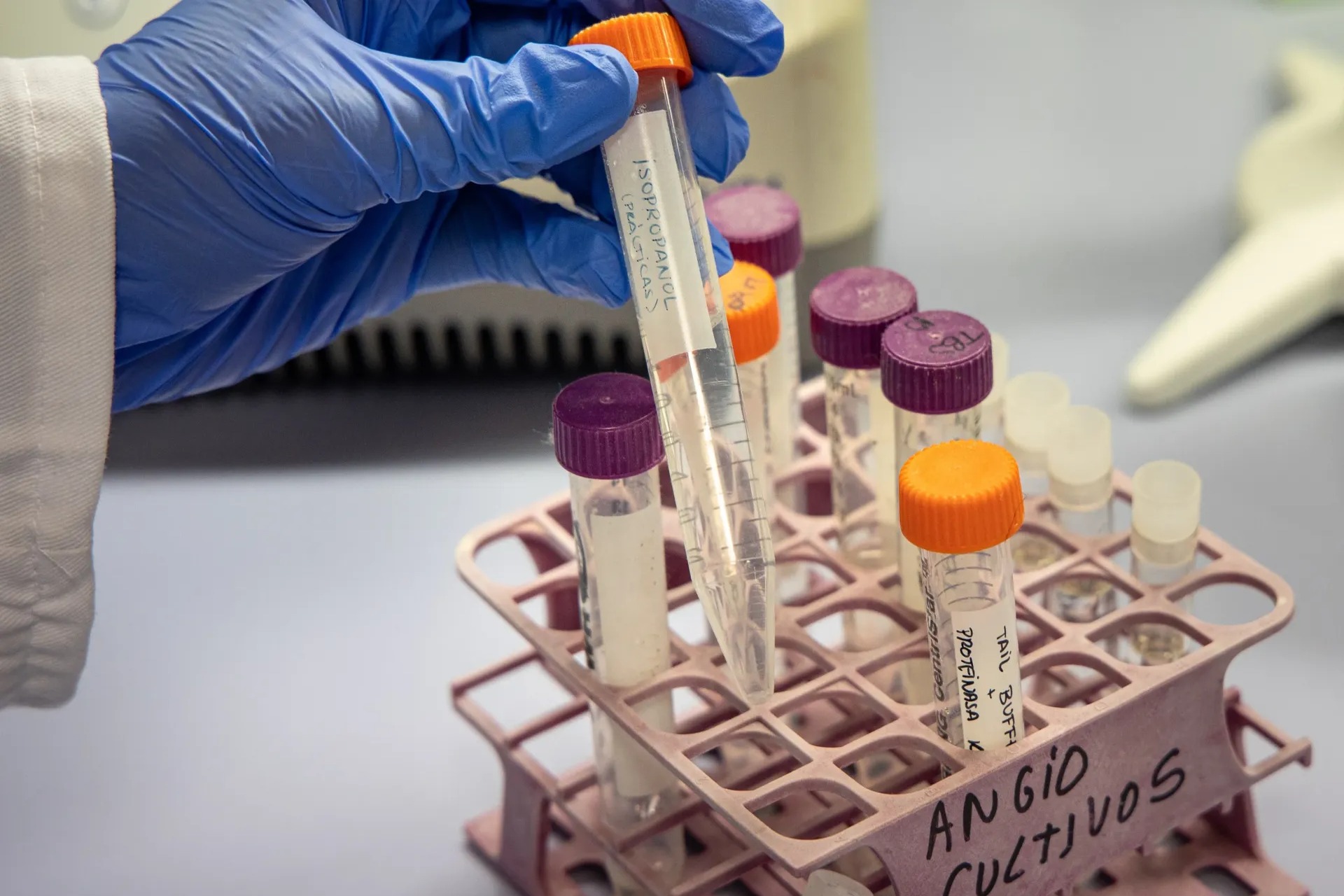 Innovadora Terapia Génica Busca Prevenir el Alzhéimer