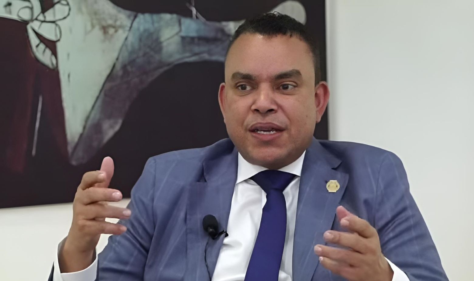 Activan Protocolos Sanitarios en RD ante Casos de Viruela Símica