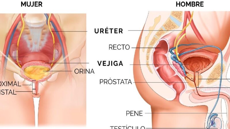 Impacto de la Estrechez Uretral en la Calidad de Vida de los Pacientes