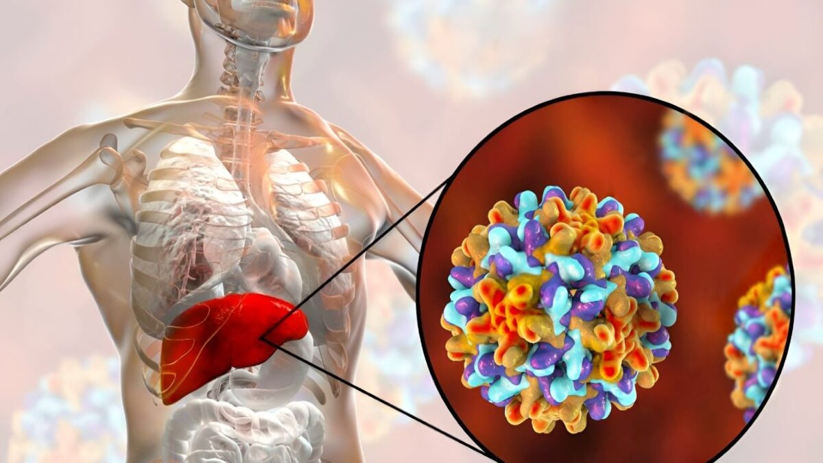 Hepatitis B y C: Las Amenazas Silenciosas para el Hígado