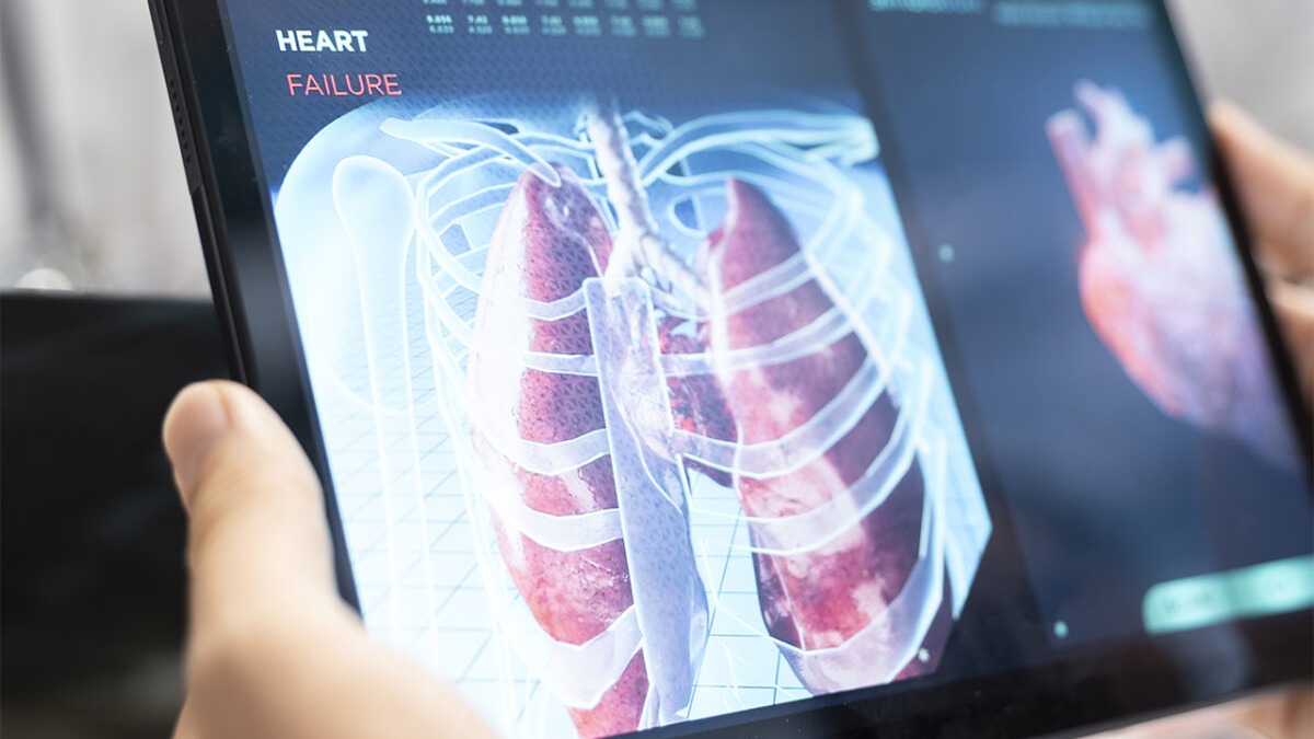 Innovadoras Pruebas Genéticas Transforman el Tratamiento de la Fibrosis Pulmonar