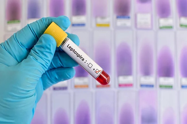 Aumento Preocupante de Leptospirosis en República Dominicana