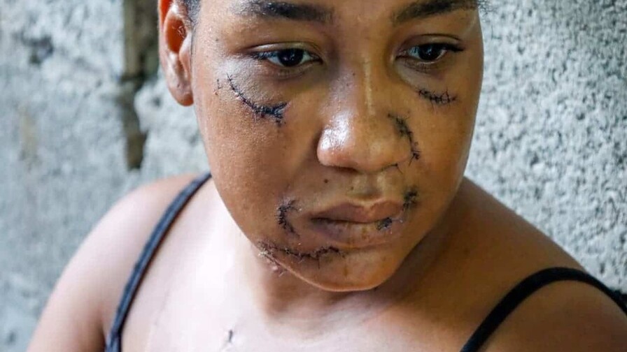 Nayely Capellán: Una Historia de Supervivencia y Esperanza