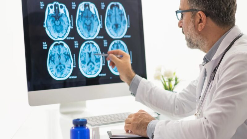 Alzheimer: Cambios Cerebrales Podrían Iniciar a los 50 Años