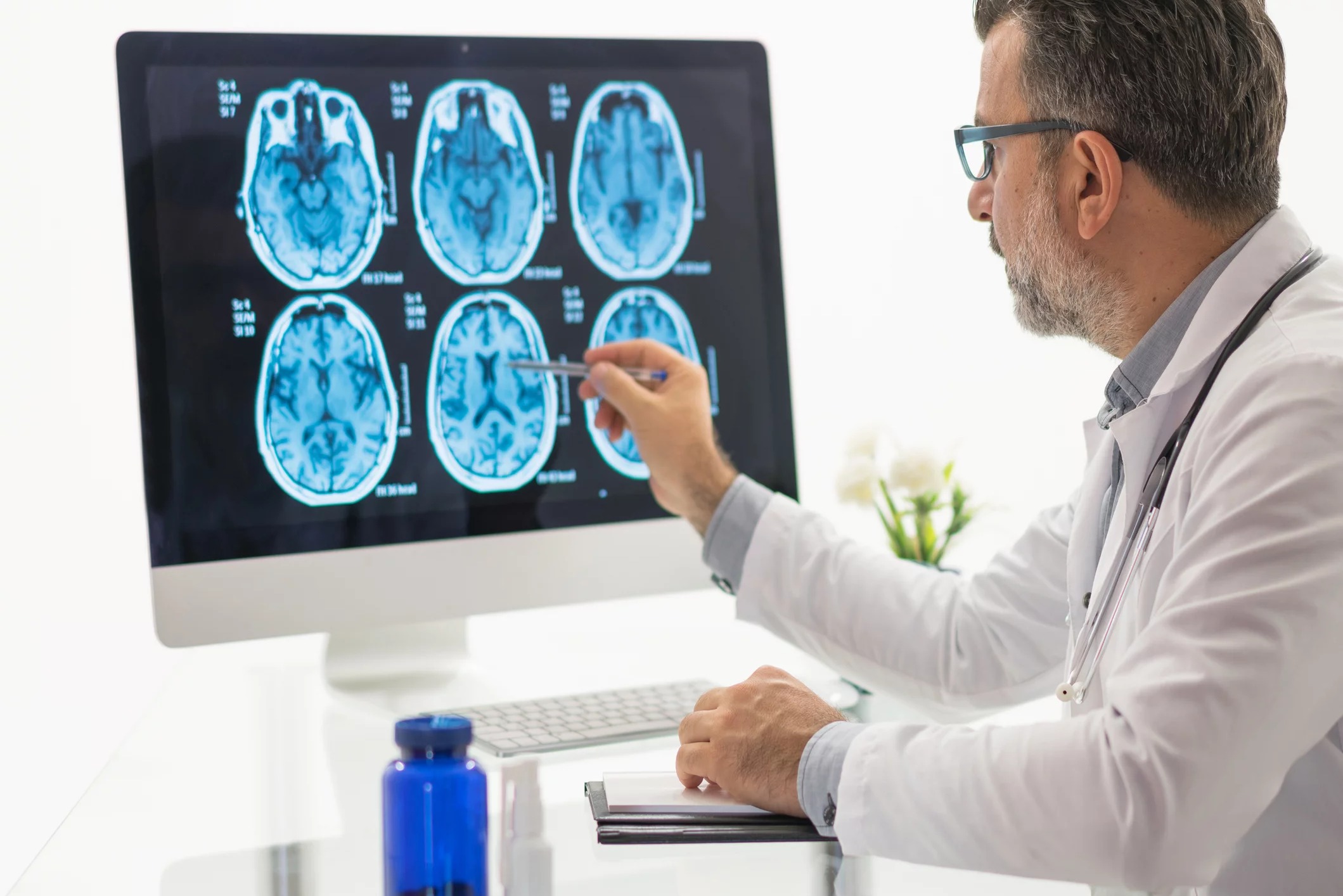 Alzheimer: Cambios Cerebrales Podrían Iniciar a los 50 Años