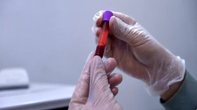 Innovadora Técnica de Sangre para Inmunoterapias Personalizadas contra el Cáncer