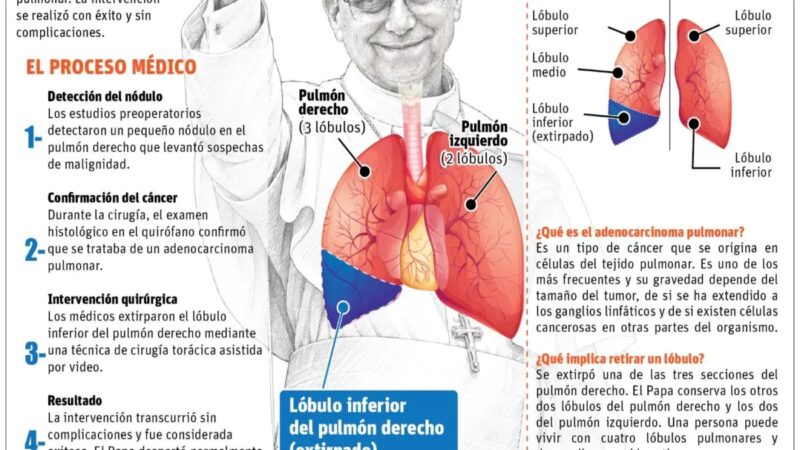 Papa León XIV se recupera exitosamente tras operación de pulmón