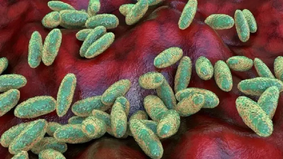 Preocupación Mundial por Muerte en Laboratorio de Siberia: ¿Qué es la Peste Neumónica?