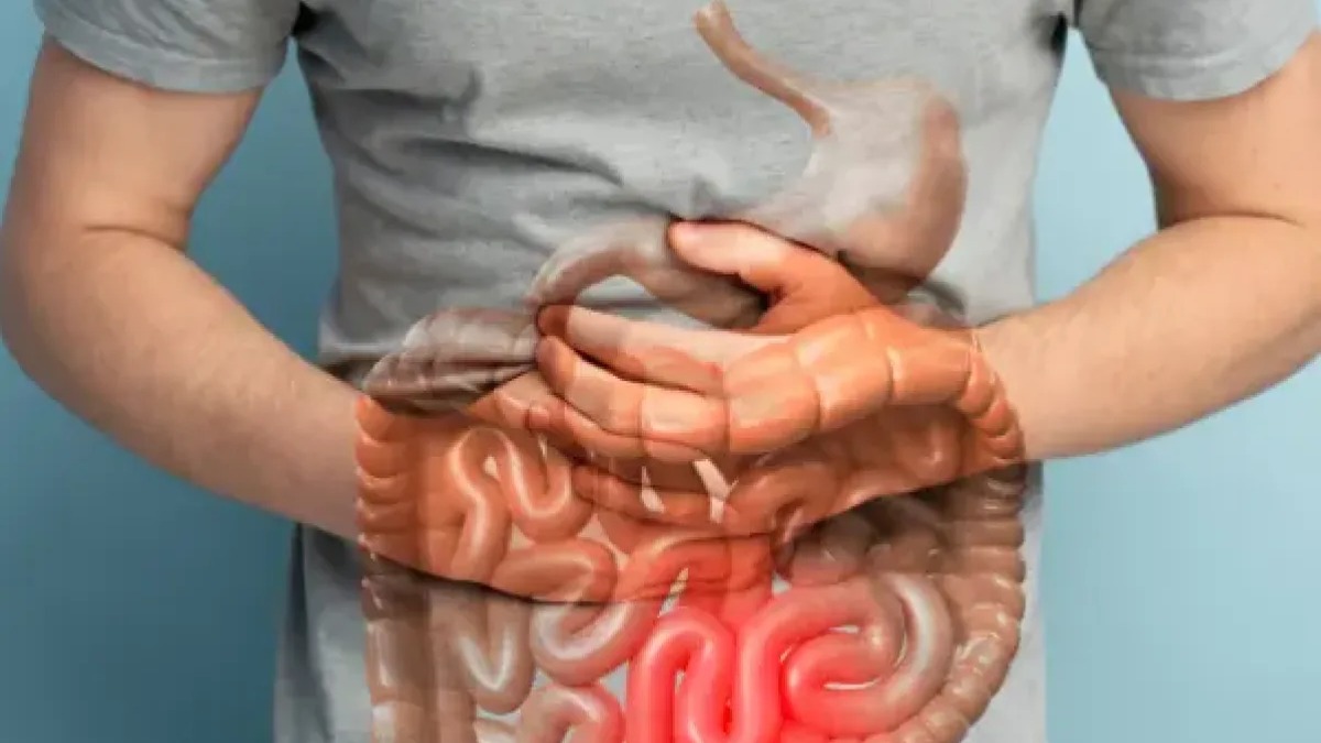 Especialista Urge a Detectar Tempranamente Enfermedades Intestinales Inflamatorias
