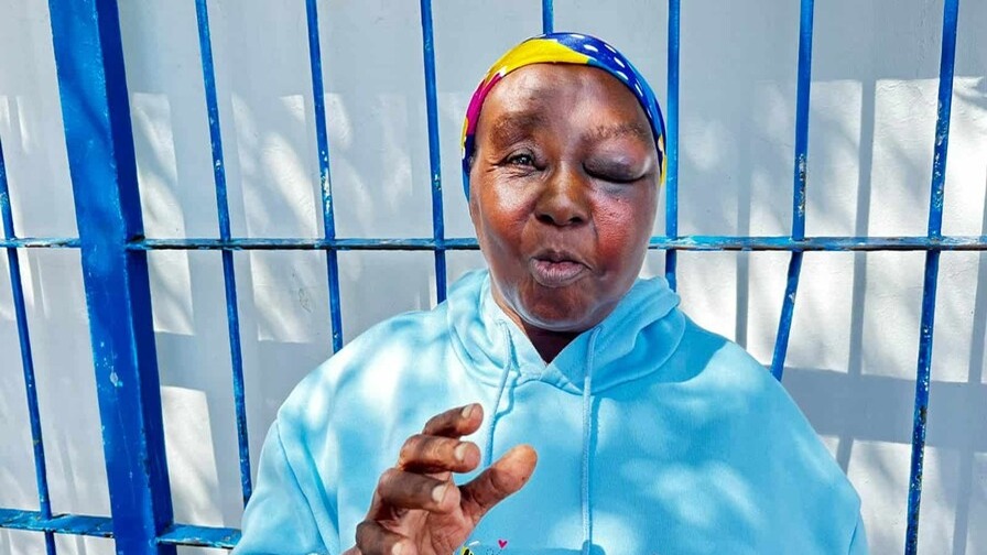 Brutal Asalto en Barahona: Mujer de 63 Años Denuncia Agresión y Robo